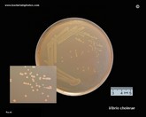 vibrio cholerae on MacConkey